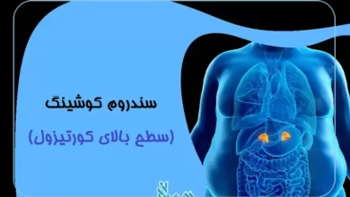 سطح کورتیزول بالا
