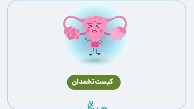 کیست تخمدان