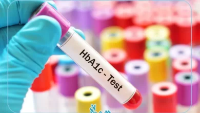 آزمایش a1c