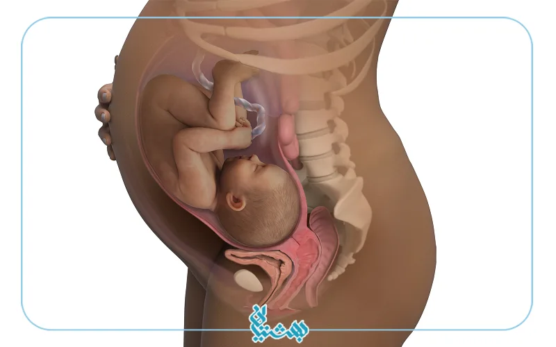 هفته سی و هشتم بارداری و شکل اندام مادر