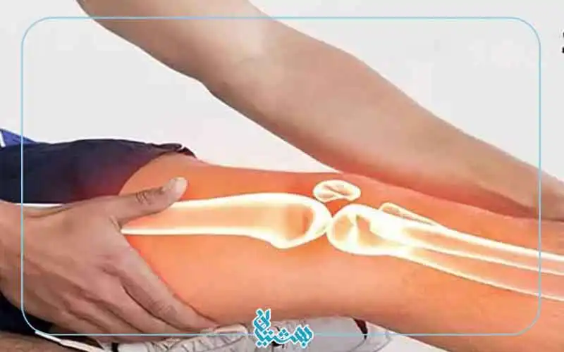 بهبود زانو درد از خواص کنجد