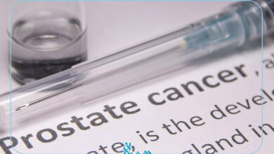 سرطان پروستات
