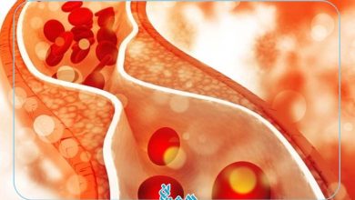 کلسترول بالا