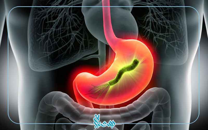 تاثیر شیرین بیان در درمان مشکلات گوارشی