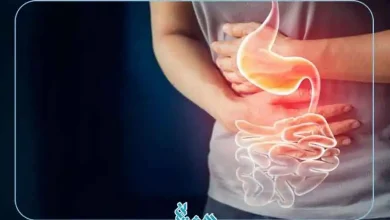 رفلاکس معده