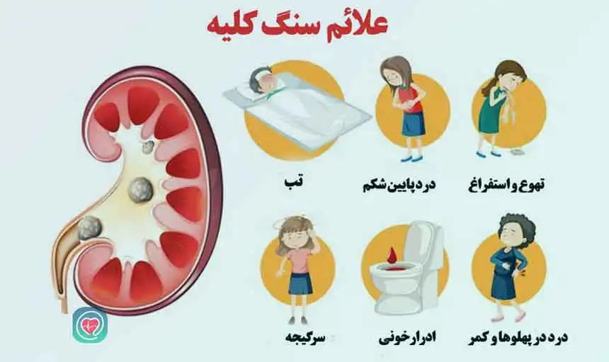علائم سنگ کلیه