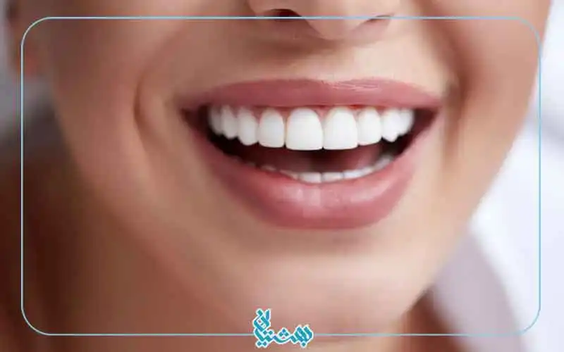 عوارض بلچینگ