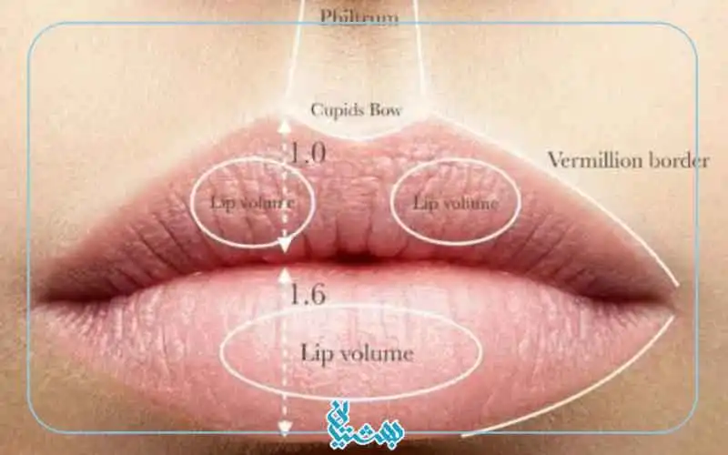 عوارض تزریق لب روسی 