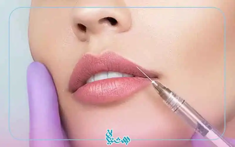 تزریق لب روسی 