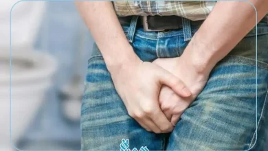 مثانه بیش فعال