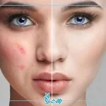 منافذ باز پوست