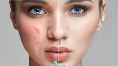 منافذ باز پوست