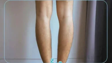 پاهای پرانتزی