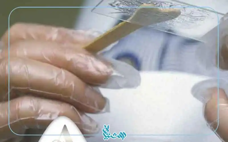ازمایش پاپ اسمیر 