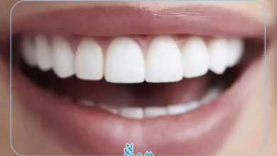 کامپوزیت کاریزما