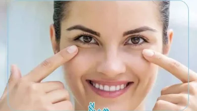 گودی زیر چشم