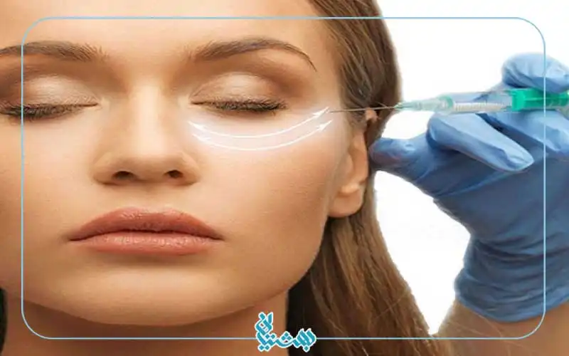 درمان گودی زیر چشم 