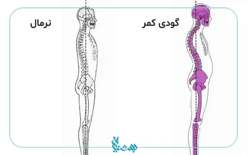 گودی کمر