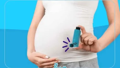 آسم بارداری