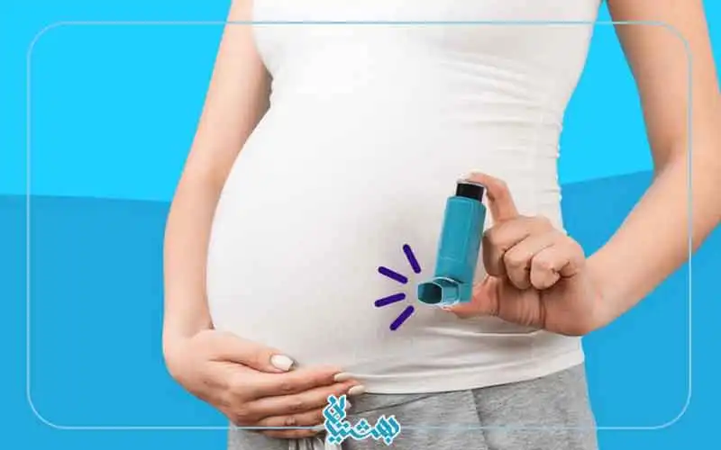 آسم بارداری