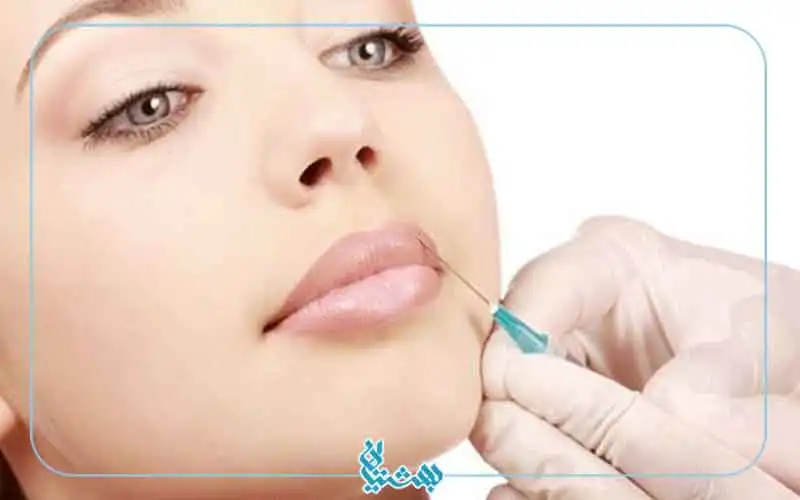 مراقبت بعد از تزریق ژل لب